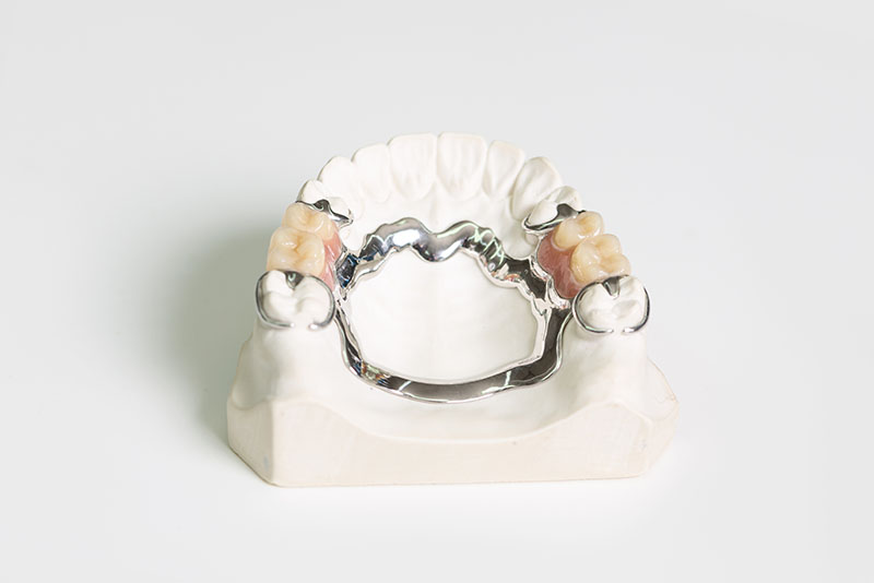 Dentures