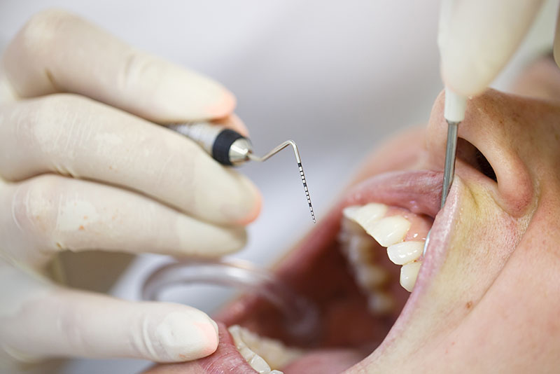 Oral Hygiene and Gum Disease