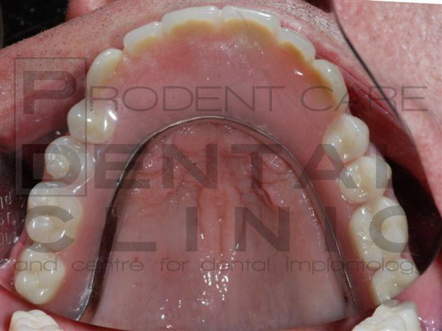 The Dental and Implantology Clinic in Malta - ProDent Care